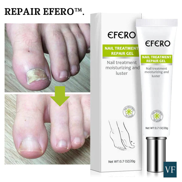 Gel de uñas anti hongos y bacterias - Repair Efero®